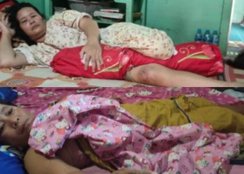 Terjatuh Dikejar Polisi, Dua Ibu-ibu Kembar di Nanga Semangut Cacat Seumur Hidup