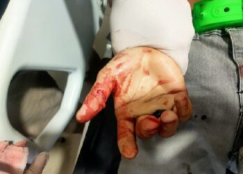 Anak Bawah Umur Disabet Celurit di Ambalat Pontianak, Diduga Pelaku Cemburu Pacarnya Dipanggil Korban